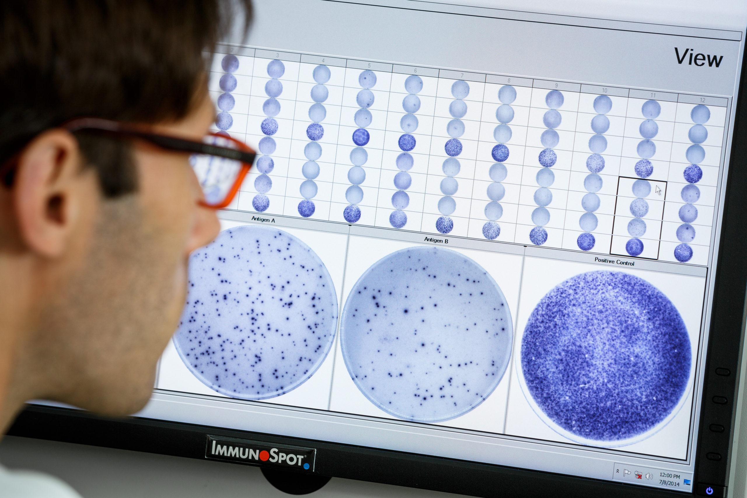 latent-tuberculosis-and-covid-19-medical-diagnostics-t-spot-technology